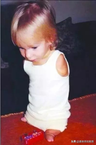 没有四肢的生命斗士,他没有腿但他却能坚强地站起来