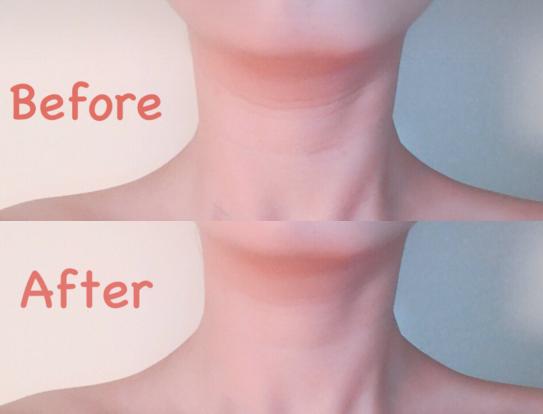 刘诗诗天鹅颈一字肩,不必羡慕刘诗诗的天鹅颈完美脸型