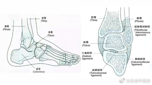 【为了您的健康，我们的专家有话说】足跟痛的黑锅不能全让骨刺来背，揪出幕后的真正元凶