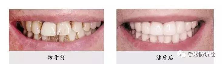 去香港专业防水补漏,去香港防骗指南