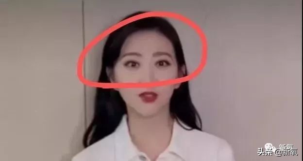 景甜修复之后的双眼皮是多宽,景甜修复后的双眼皮多宽