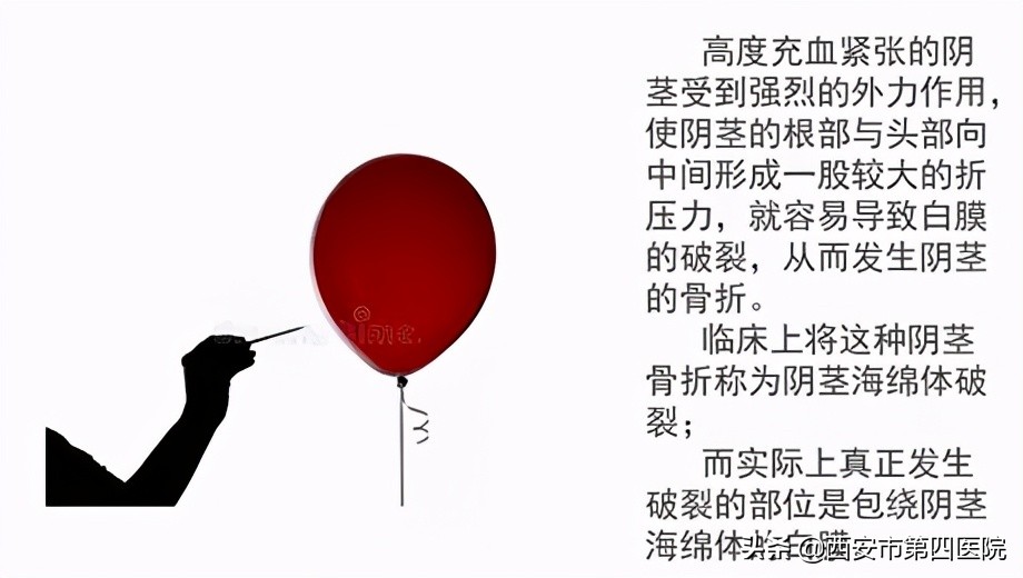 #健康中国行动2030#丁丁断了也能修！精湛医术“把根留”