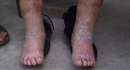 6000多头羊突然暴毙，引出了美方隐藏已久的生化计划