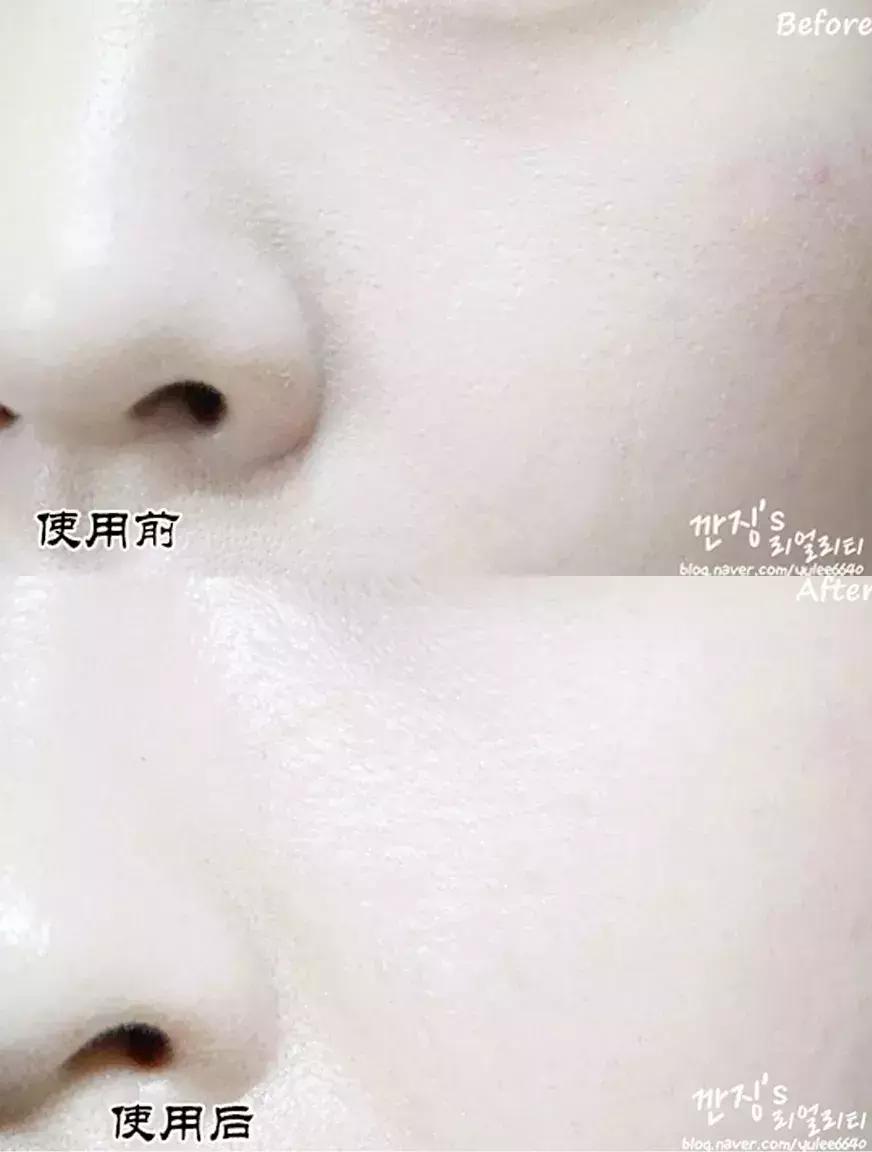 欧阳娜娜擦的药膏,欧阳娜娜擦什么药膏