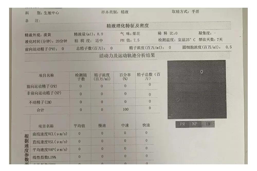 原来有精子突然无精怎么办,明明精子活力不高但是医生说没事