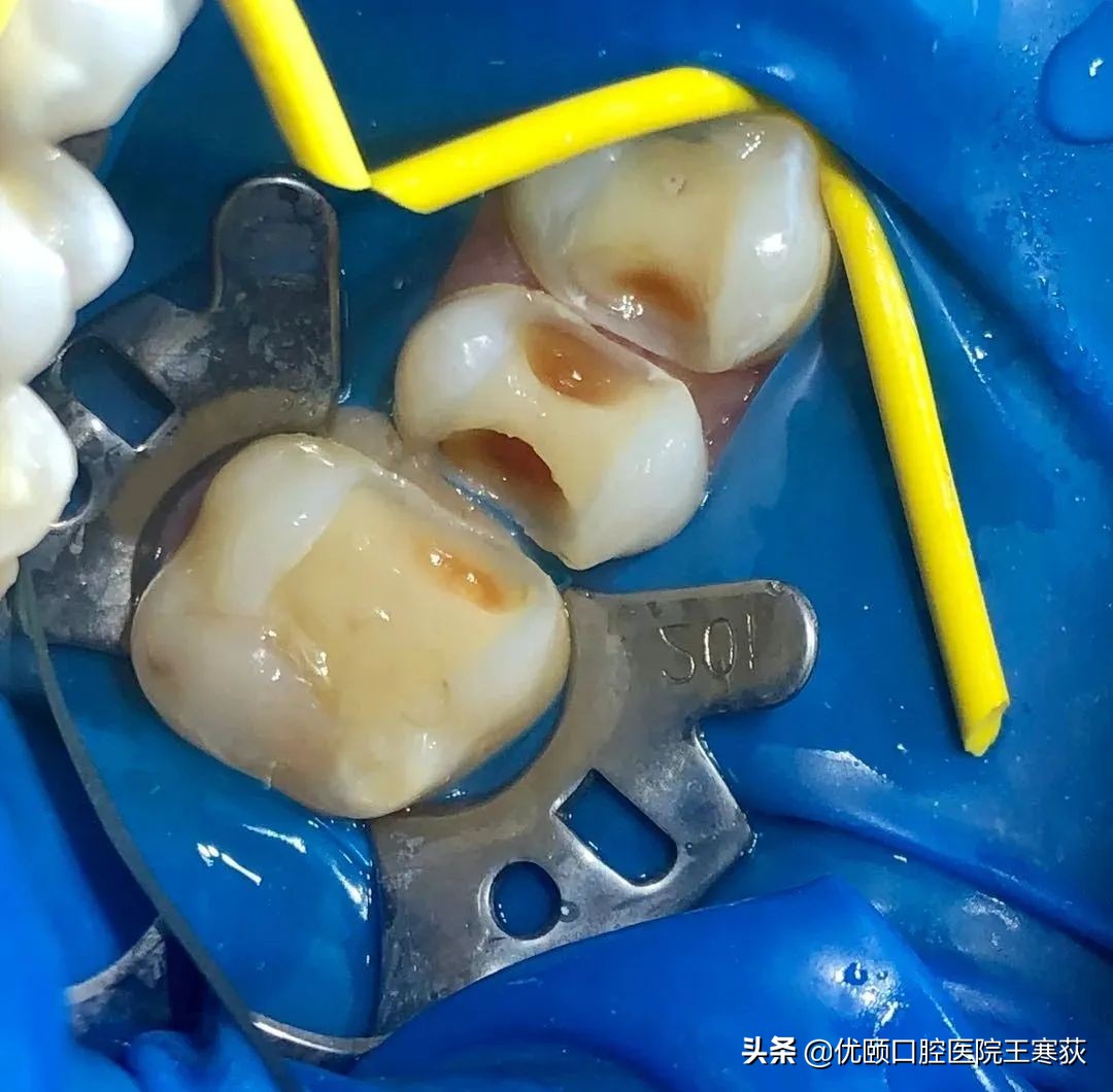 睡眠解决健康问题,睡眠解决一切问题