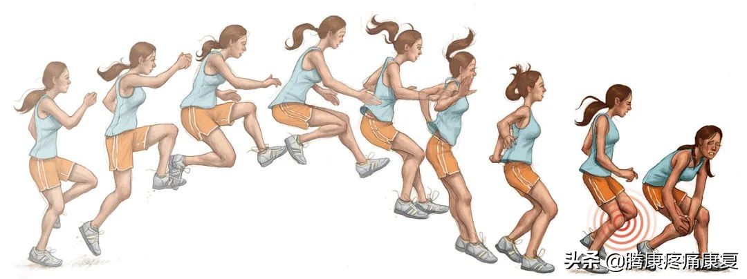 前交叉韧带断裂半月板后角撕裂,左膝前交叉韧带部分撕裂怎么办