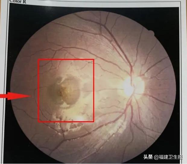 7宀佺敺瀛╁彸鐪艰鐑т激,7宀佺敺瀛╃溂鐫涜鐑т激