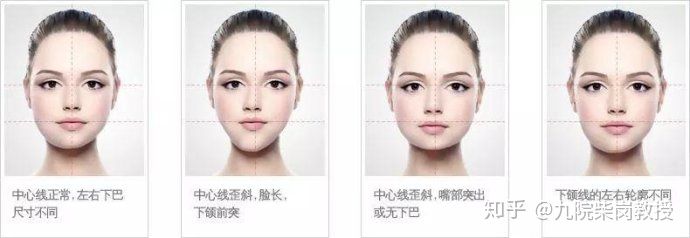 整容避坑知识,整容怎么解决脸大的问题