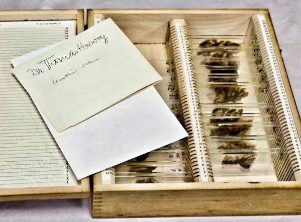 爱因斯坦大脑被偷背后的真相,爱因斯坦大脑被取出全过程