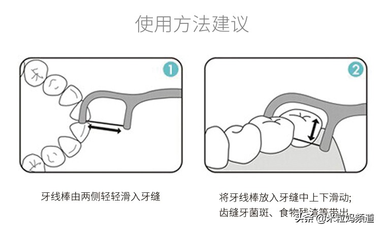 小朋友的蛀牙是怎么形成的,10岁小孩有7颗蛀牙