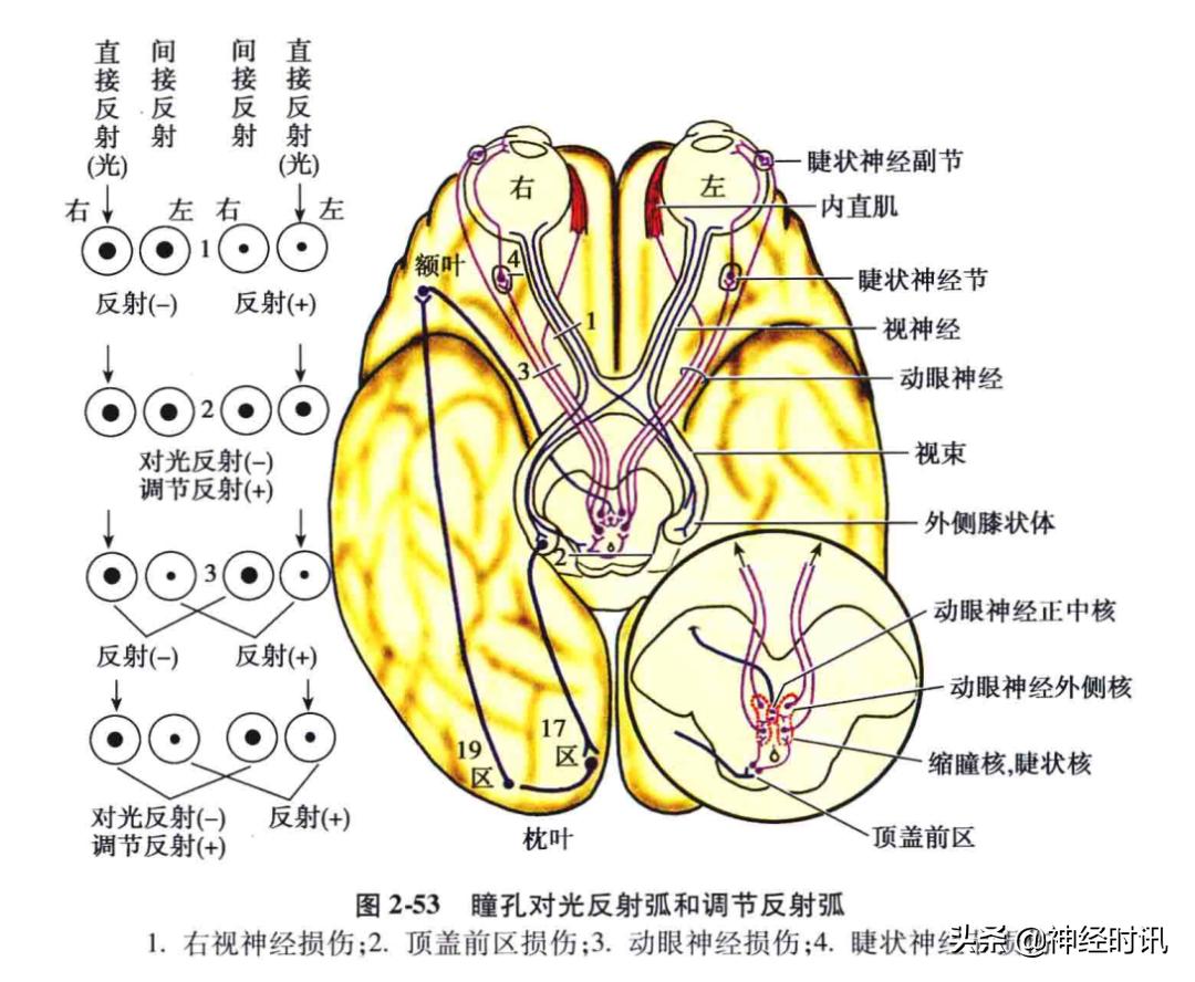 脑干解剖,脑干神经解剖