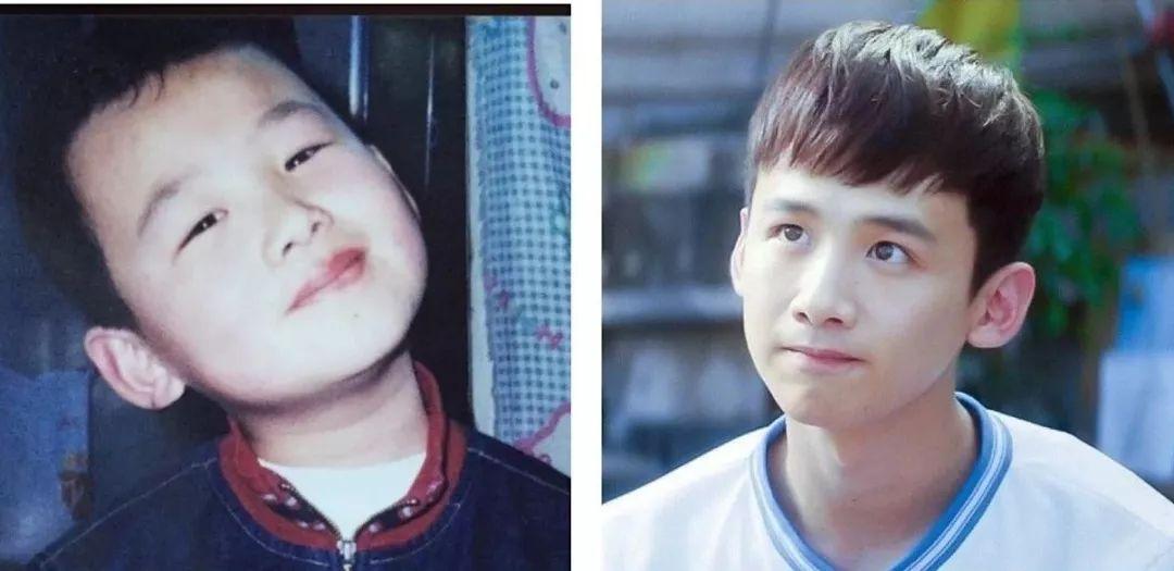 眉毛整容有几种方案,现在男生整容多吗