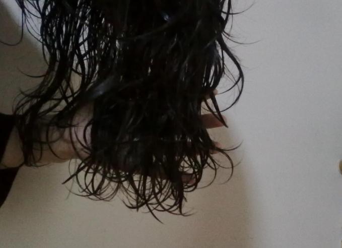 头皮长小疙瘩抠破有脓怎么办,头皮长了个疙瘩破了怎么办