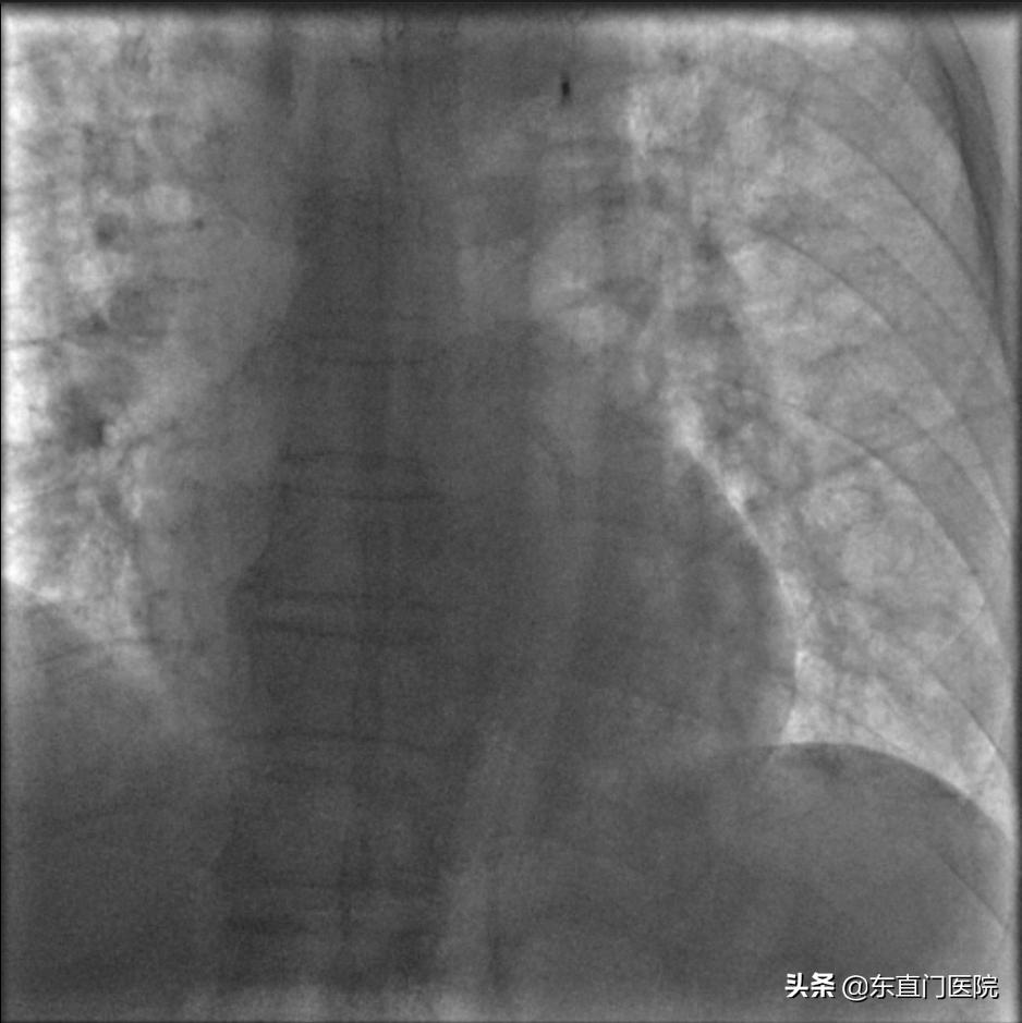 精确规范力挽狂澜