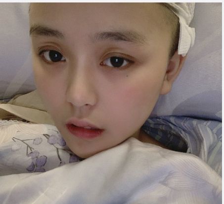 斗鱼主播纳豆生病视频,主播纳豆nado生了什么病