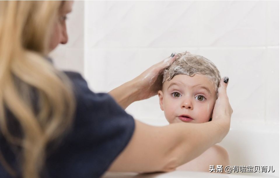 宝宝头发问题,宝宝头发少头发黄怎么办