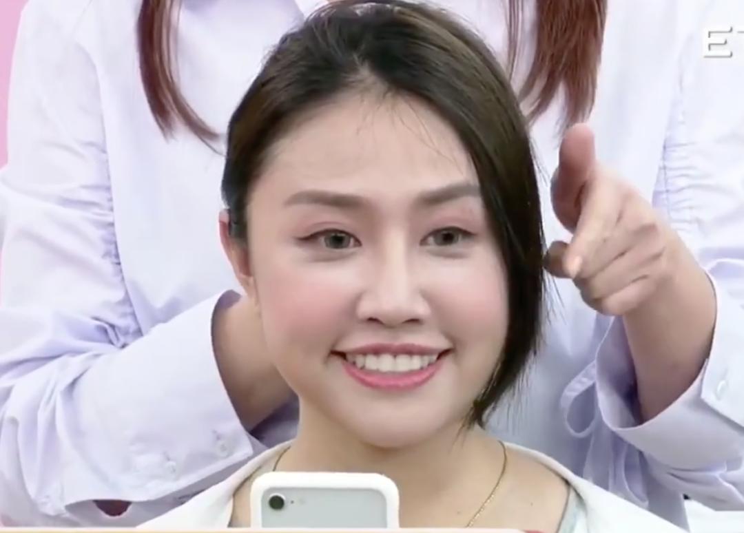 头发秃发量少该怎么拯救,头发秃扁怎么办小妙招