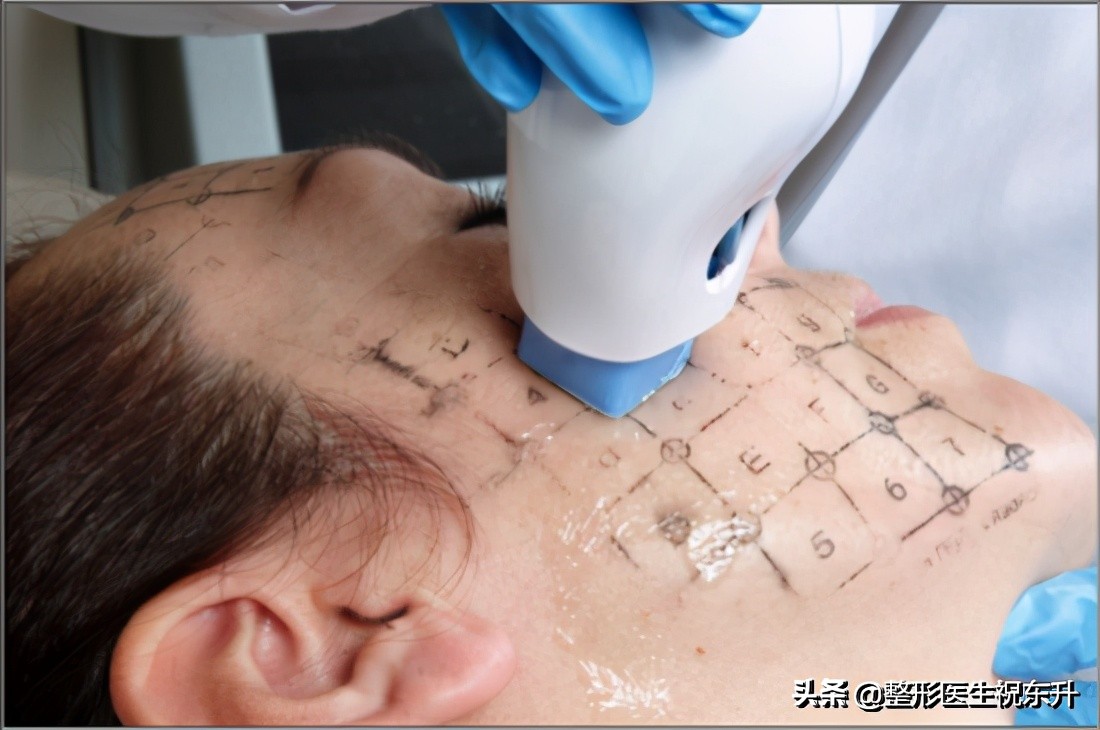 热玛吉有必要指定医生做吗,为什么不建议做热玛吉