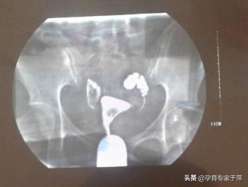 青岛医生于萍视频,于萍主任青岛