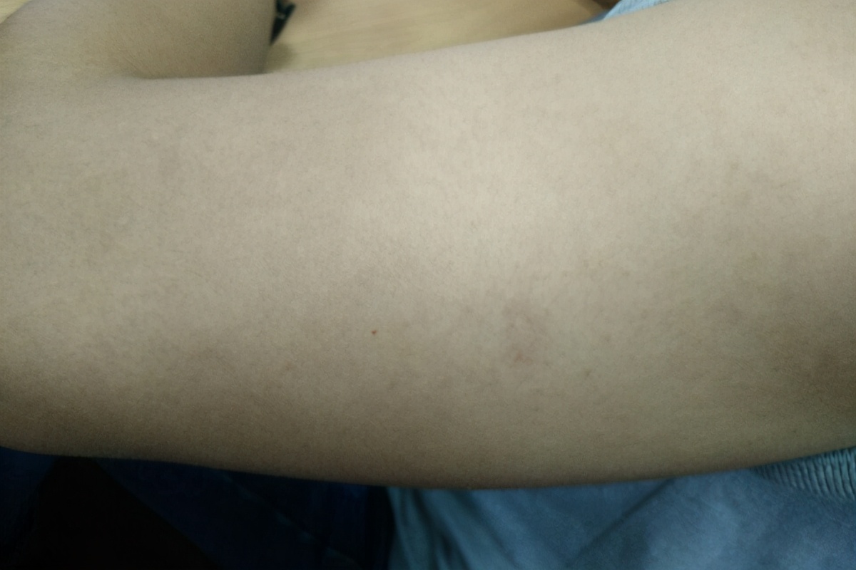 换季脸部起皮泛红用什么水,一到换季脸就脱皮是怎么回事