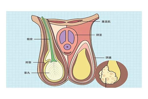 男性睾酮丸疼痛等级,男性睾酮丸周围疼