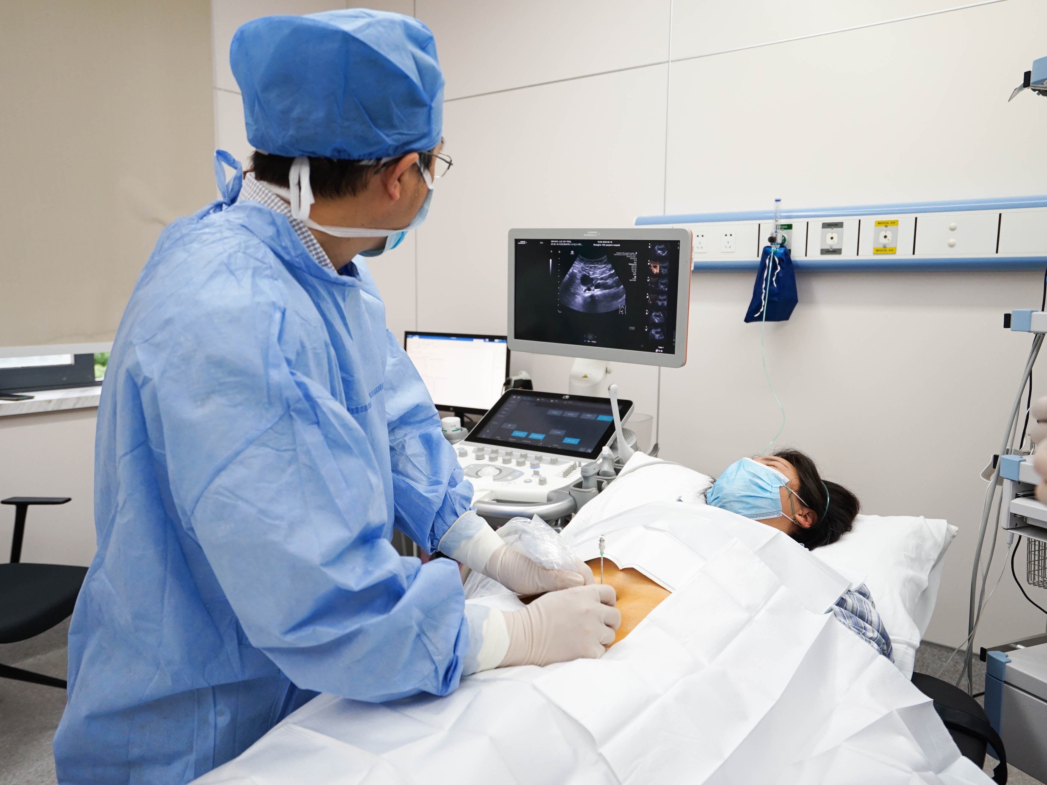 每25名育龄女性就有1名巧囊患者,规范巧囊超声介入治疗,上海十院牵头制定专家共识