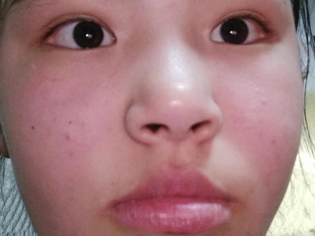 嘴唇好丑怎么变好看,嘴唇为何会越变越难看