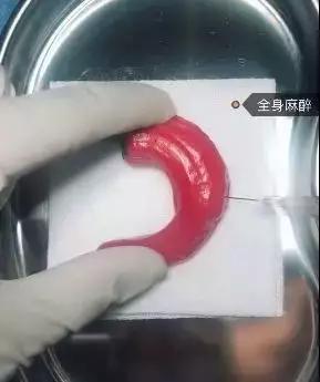 香蕉割包皮,洋葱剖腹产?这是我见过最秀的医生