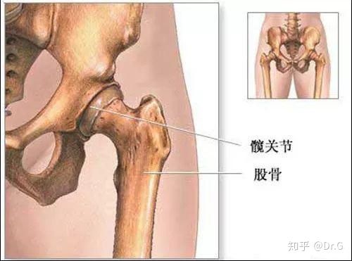 短时间用激素一定会股骨头坏死吗,没服过激素会股骨头坏死吗