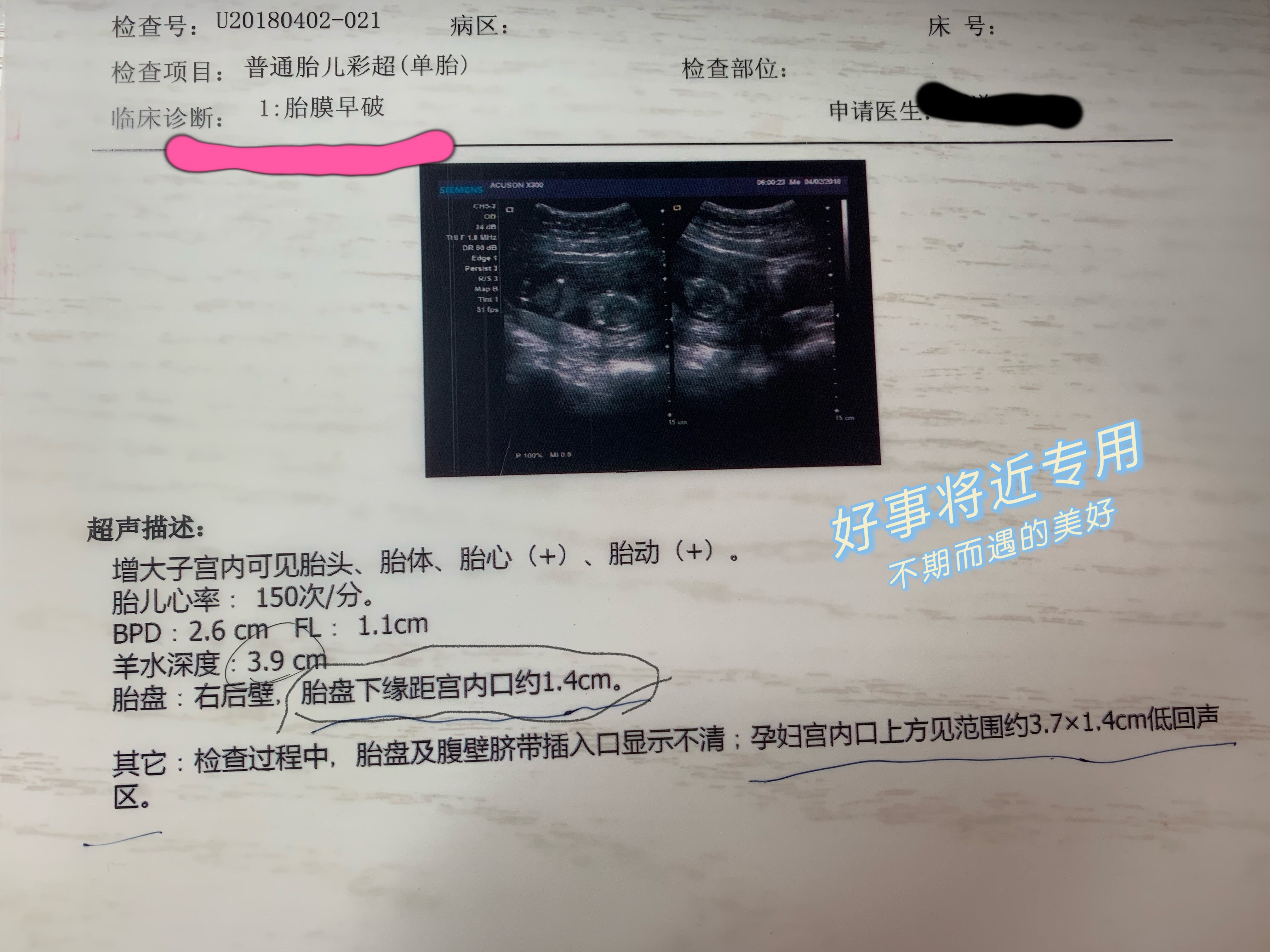 怀孕16周羊水早破保胎成功的经历