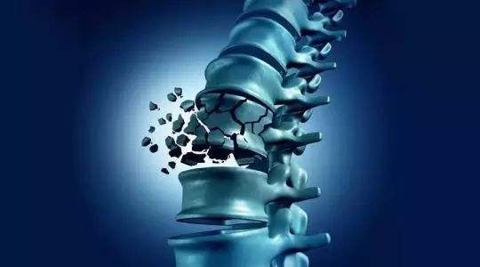 氨糖和液体钙能长期服用吗,50岁吃哪种氨糖钙好