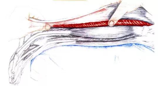 跑步跟腱炎最好的治疗方法,跟腱炎跑步不疼跳起来疼