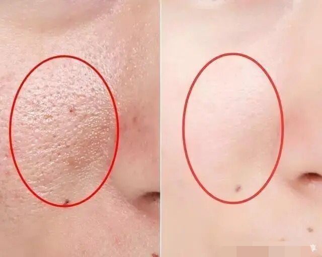 李佳琦推荐黄圣依面膜,李佳琦黄圣依美妆仪