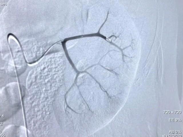 鲁渝扶贫协作简介,鲁渝扶贫协作十年成效卓著