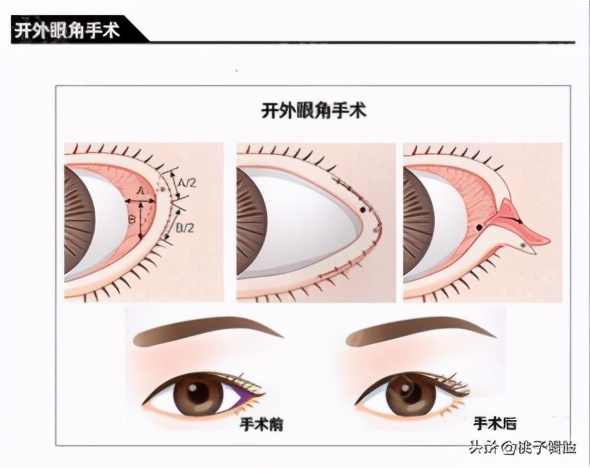 明明面无表情却被人说,明明面无表情但看起来很凶