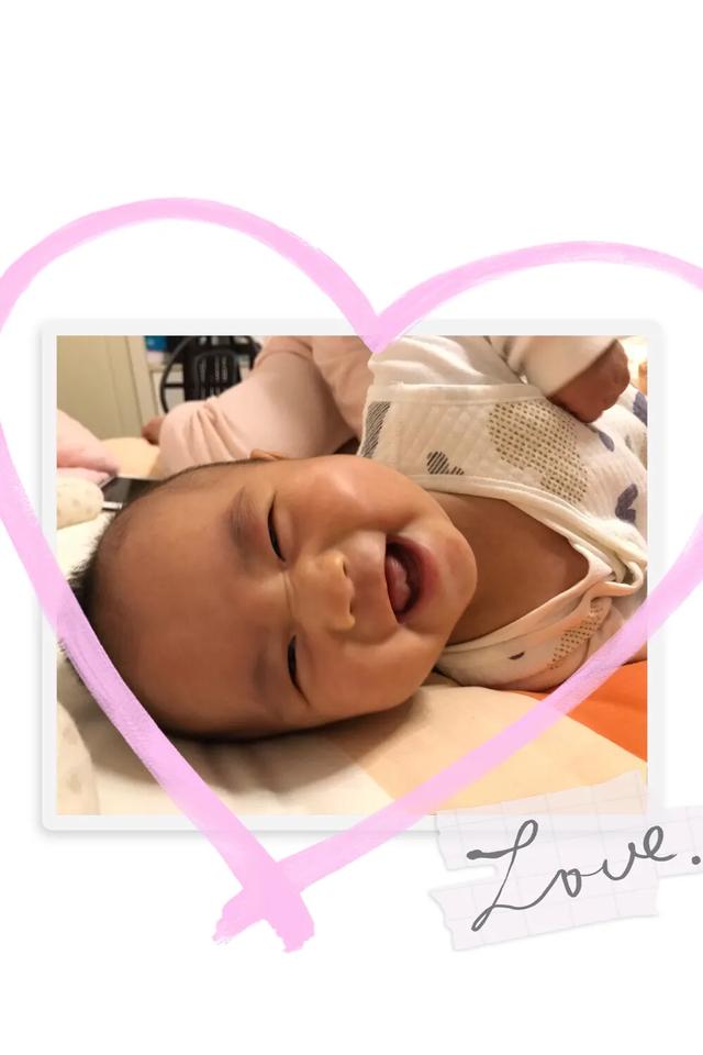 胎儿38了可以去剖了嘛,孕38周剖好不好