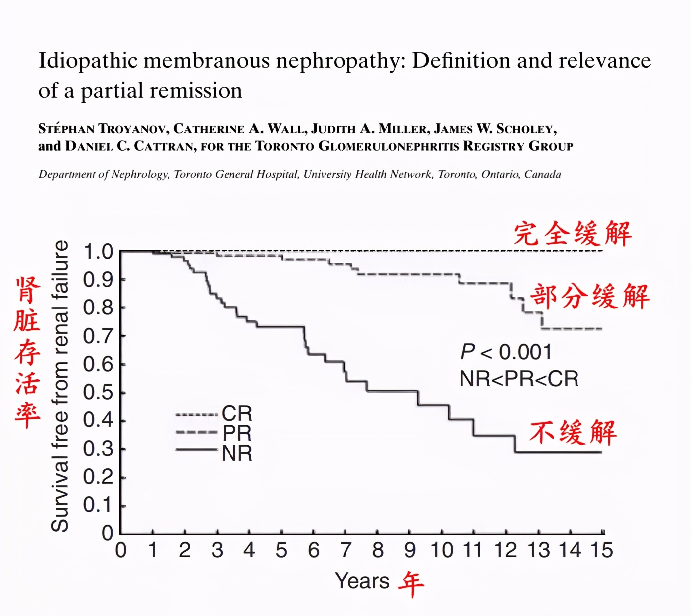 膜性肾病指南解读,谈谈膜性肾病治疗的新进展