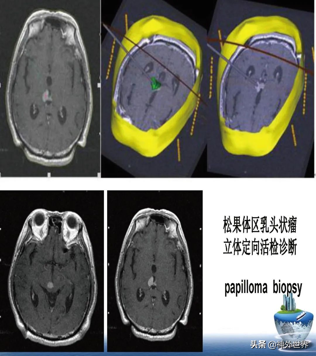 宣武医院神经外科王亚明祖籍,北京宣武医院神经科专家王亚明
