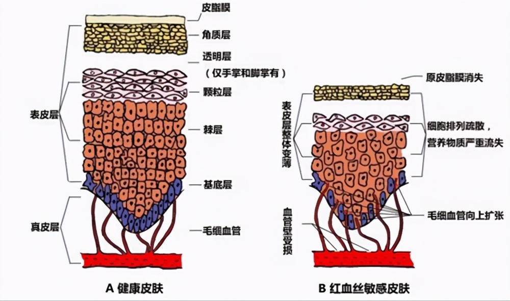 脸上有红血丝用什么护肤品国货,日系护肤品哪些适合红血丝