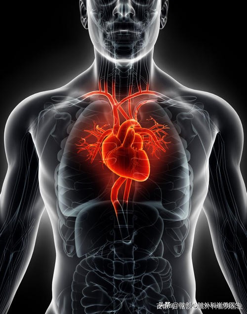 老人心脏换瓣建议机械还是生物,老人换人工瓣膜