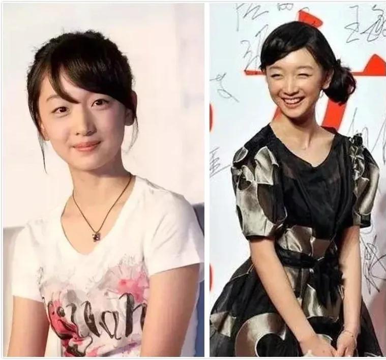 周冬雨过去的小粗腿,小粗腿逆袭