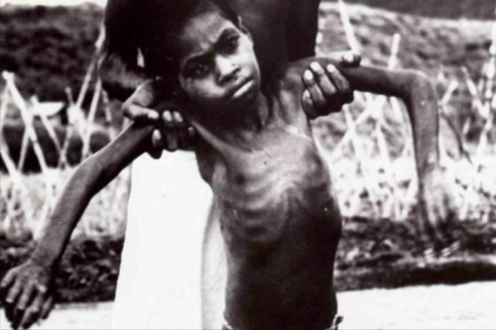 致死率百分百疾病,感染朊病毒有多可怕