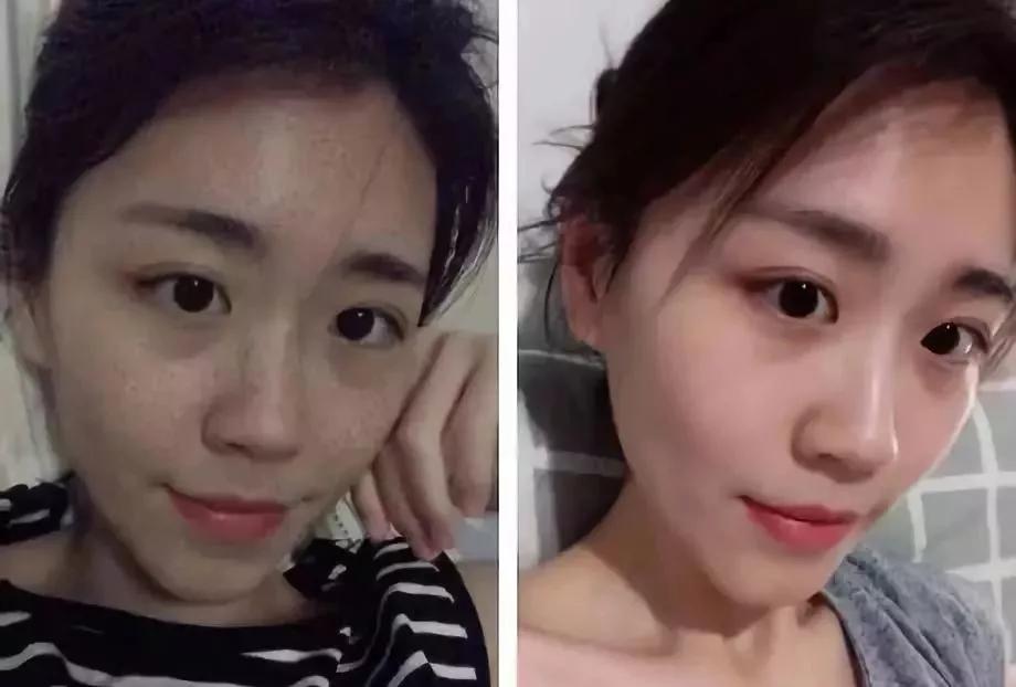 美白祛黄提亮肤色泡水喝,每天喝一杯可以美白淡斑清热解毒