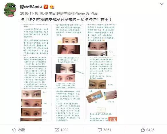 把水光针当饭吃？这位网红简直丧心病狂！整容后年入千万