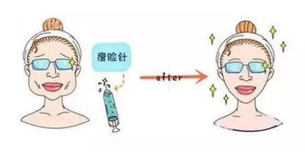 科普|光子嫩肤全攻略，做了光子后禁忌事项有哪些？