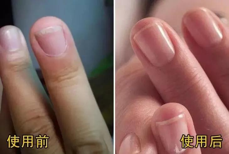 指甲刀中的劳斯莱斯,德国高端指甲剪指甲刀