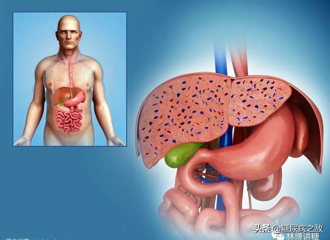 糖尿病吃什么降糖最快不伤肝,得了糖尿病打胰岛素就没事了吗