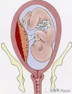 怀孕分娩医生最想告诉你的哪些事,孕产那些事