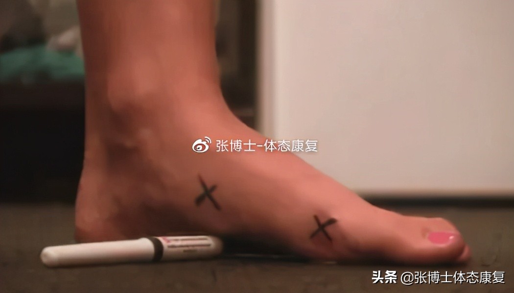 体态畸形怎么矫正,体态矫正腿型修复前景怎样